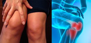 Хронический артрит коленного сустава