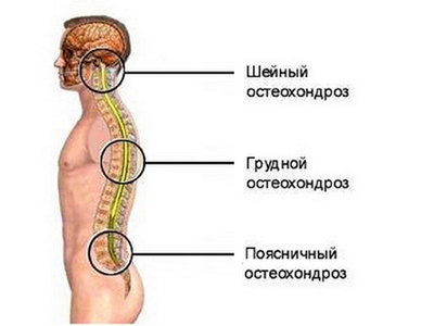 Пиелонефрит сильная головная боль