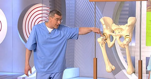 Болезни суставов и особенности строения тазобедренных суставов