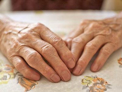 Полиартрит пальцев рук: симптомы и лечение народными средствами, медикаментозное лечение препаратами