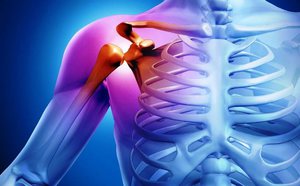 Артрит плеча - особенности заболевания
