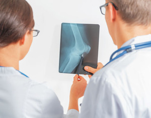 Лечение артрита коленного сустава