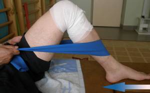 Реабилитация после протезирования коленного сустава