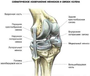 Какие признаки у растяжки коленного сустава