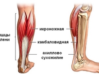 Ахиллесово сухожилие - почему происходит разрыв