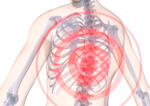 Остеохондроз грудного отдела - почему он возникает?