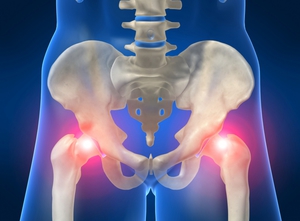 Изображение - Болезни тазобедренного сустава у женщин лечение vospaleniya-sustavov