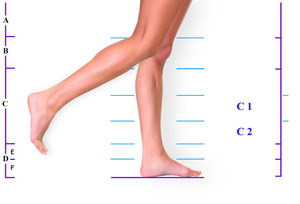 Как определить род заболевания ног