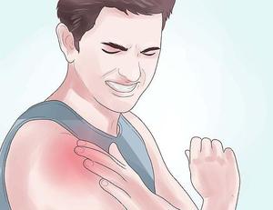 Как проявляется заболевание плечевого сустава