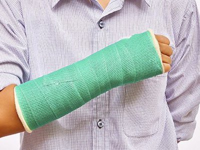 Реабилитация после перелома лучевой кости со смещением: основные этапы ...