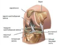Какие могут быть повреждения мениска коленного сустава